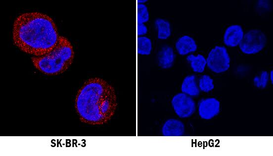 RIPK3/RIP3 antibody in SK-BR-3 and HepG2 Human Cell Lines by Immunocytochemistry (ICC).
