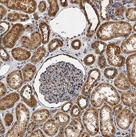 RIPK4/RIP4 antibody in Human Kidney by Immunohistochemistry (IHC-P).