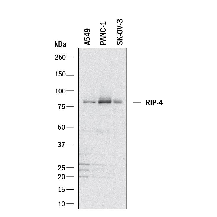 Detection of Human RIPK4/RIP4 antibody by Western Blot.