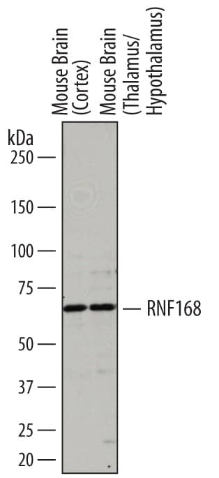 Detection of Mouse RNF168 antibody by Western Blot.