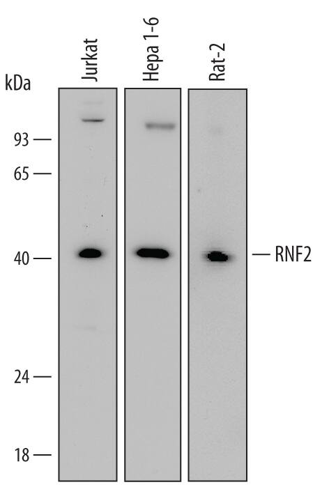 Detection of Human, Mouse, and Rat RNF2 antibody by Western Blot.