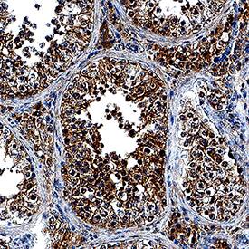 RNF4 antibody in Human Testis by Immunohistochemistry (IHC-P).