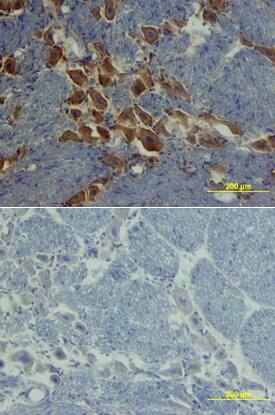 ROBO1 antibody in Rat Brain by Immunohistochemistry (IHC-Fr).