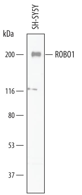 Detection of Human ROBO1 antibody by Western Blot.