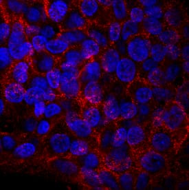 ROBO1 antibody in HepG2 Human Cell Line by Immunocytochemistry (ICC).
