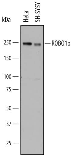 Detection of Human ROBO1 antibody by Western Blot.