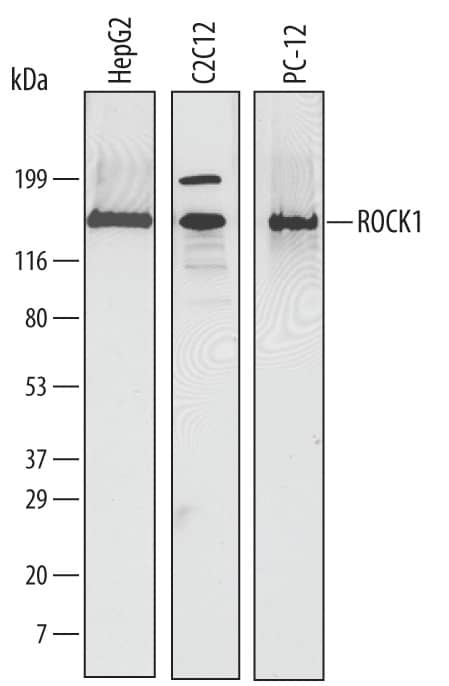 Detection of Human, Mouse, and Rat ROCK1 antibody by Western Blot.