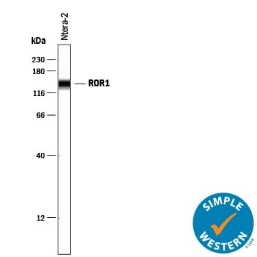 Detection of Human ROR1 antibody by Simple WesternTM.