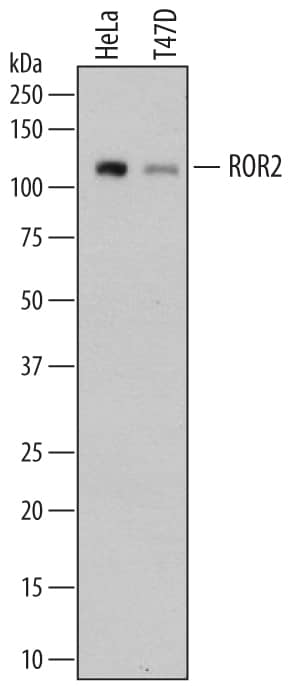 Detection of Human ROR2 antibody by Western Blot.