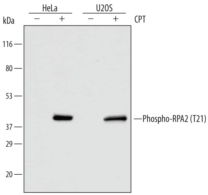 Detection of Human Phospho-RPA2 (T21) antibody by Western Blot.