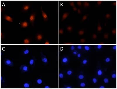 RSK1 antibody in HeLa Human Cell Line by Immunocytochemistry (ICC).