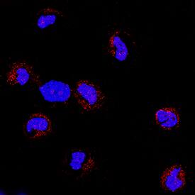 RTTN antibody in HDLM-2 Human Cell Line by Immunocytochemistry (ICC).