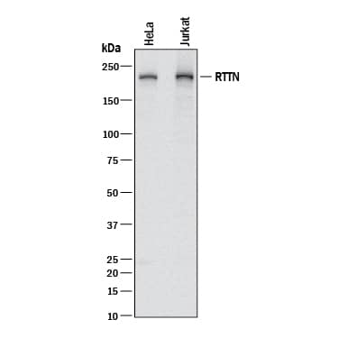 Detection of Human RTTN antibody by Western Blot.