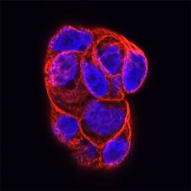 Rab13 antibody in Caco-2 Human Cell Line by Immunocytochemistry (ICC).