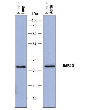 Detection of Human Rab13 antibody by Western Blot.