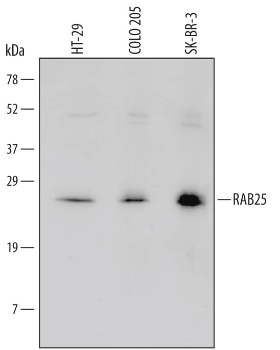 Detection of Human RAB25 antibody by Western Blot.