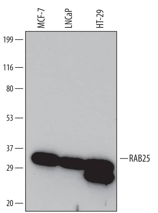 Detection of Human RAB25 antibody by Western Blot.