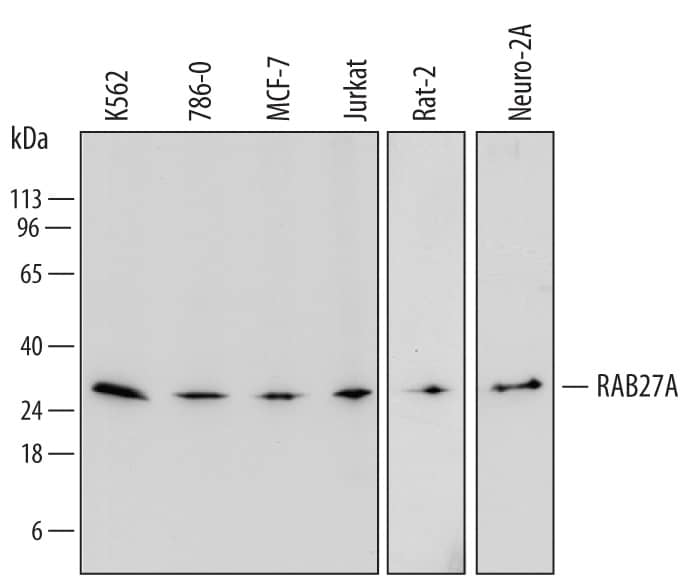 Detection of Human, Mouse, and Rat RAB27A antibody by Western Blot.