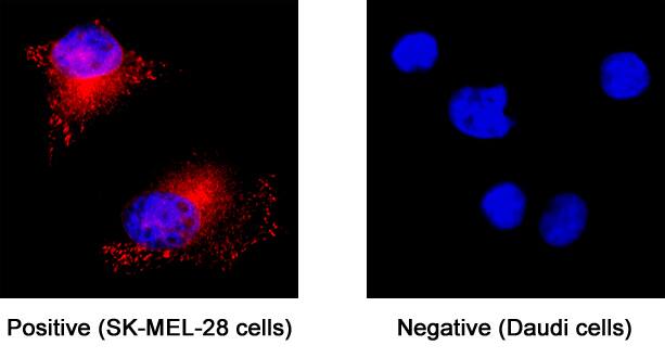 Rab27a antibody in SK-Mel-28 Human Cell Line by Immunocytochemistry (ICC).