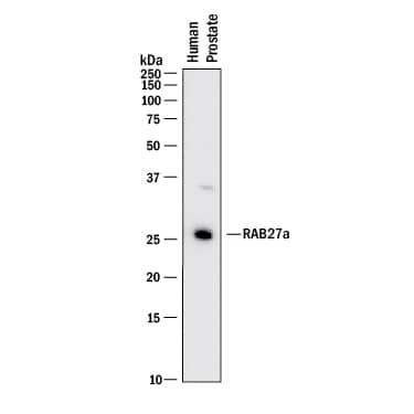 Detection of Human Rab27a antibody by Western Blot.