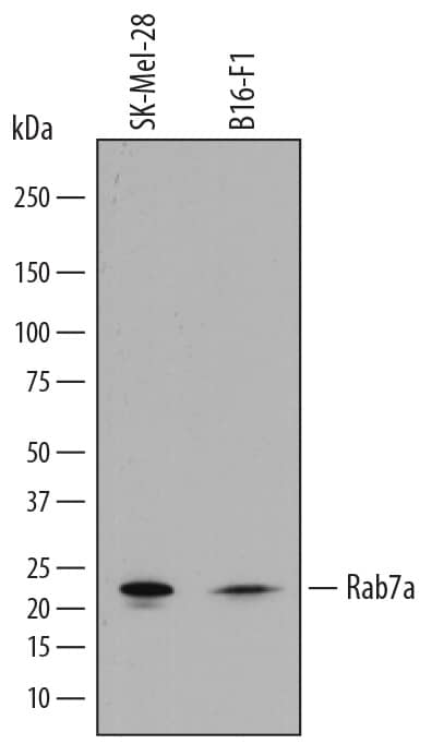 Detection of Human and Mouse Rab7a antibody by Western Blot.