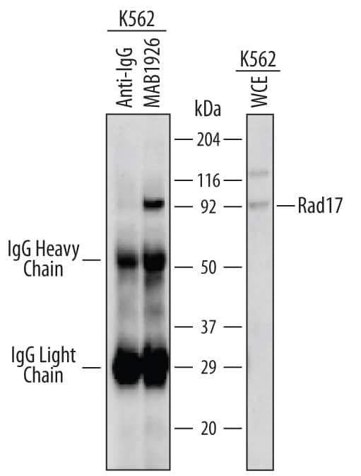 Immunoprecipitation of Human Rad17.