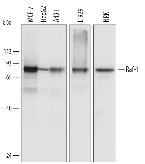 Detection of Human, Mouse, and Rat Raf-1 antibody by Western Blot.