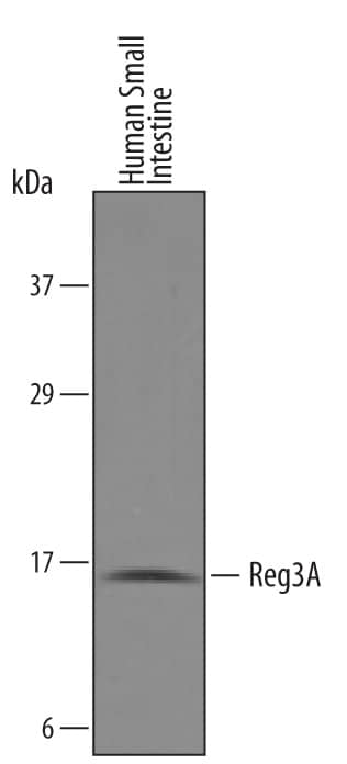 Detection of Human Reg3A antibody by Western Blot.