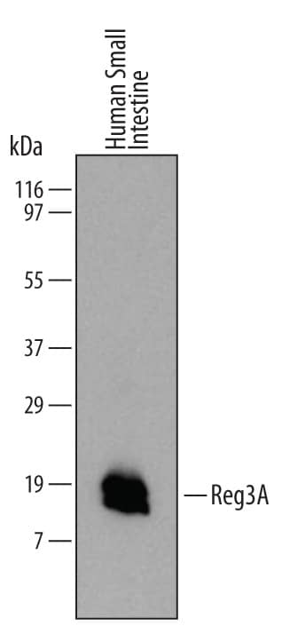 Detection of Human Reg3A antibody by Western Blot.