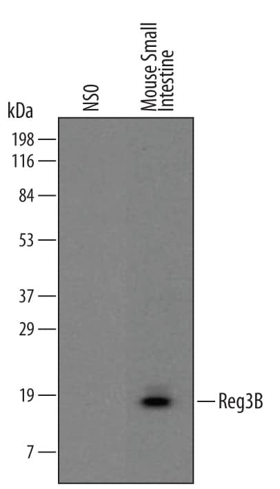 Detection of Mouse Reg3B antibody by Western Blot.