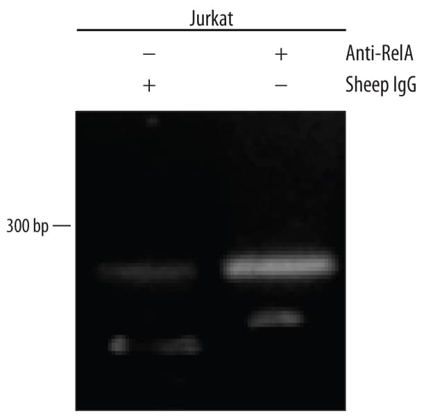 Detection of RelA/NF kappaB p65-regulated Genes by Chromatin Immuno-precipitation.