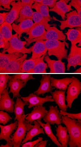 RelA/NF?B p65 antibody in HeLa Human Cell Line by Immunocytochemistry (ICC).