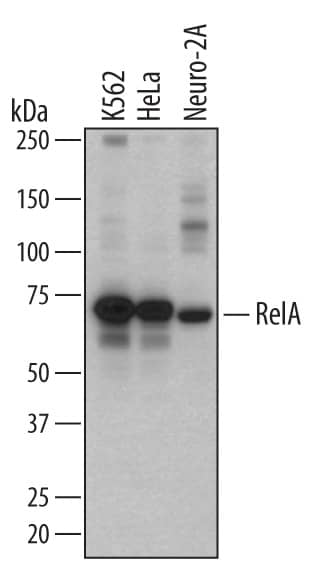 Detection of Human and Mouse RelA/NF?B p65 antibody by Western Blot.