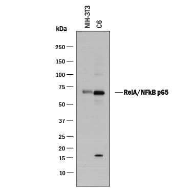 Detection of Mouse and Rat RelA/NF?B p65 antibody by Western Blot.