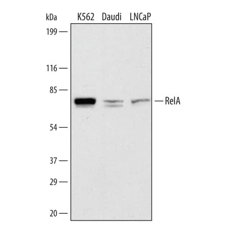 Detection of Human RelA/NF?B p65 antibody by Western Blot.