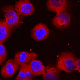 RelA/NF?B p65 antibody in K562 Human Cell Line by Immunocytochemistry (ICC).