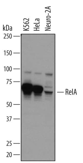 Detection of Human and Mouse RelA/NF?B p65 antibody by Western Blot.