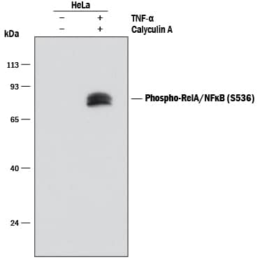 Detection of Human Phospho-RelA/NF?B p65 (S536) antibody by Western Blot.