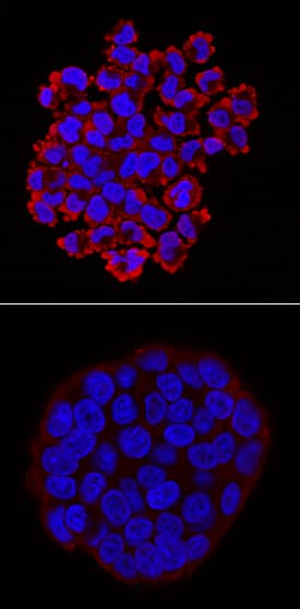 Phospho-RelA/NFkB p65 (S536) antibody in HT-29 Human Cell Line by Immunocytochemistry (ICC).