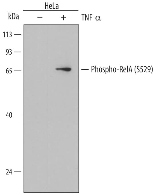 Detection of Human Phospho-RelA/NF?B p65 (S529) antibody by Western Blot.