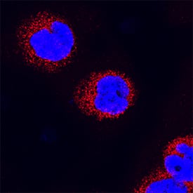 RelB antibody in Raji Human Cell Line by Immunocytochemistry (ICC).