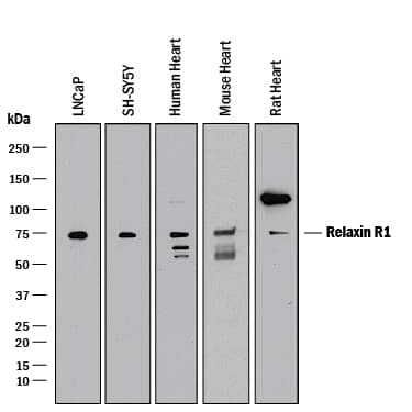 Detection of Human, Mouse, and Rat Relaxin R1 antibody by Western Blot.