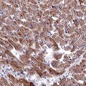 Relaxin R2 antibody in Human Heart by Immunohistochemistry (IHC-P).