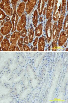 Renin antibody in Human Kidney by Immunohistochemistry (IHC-P).