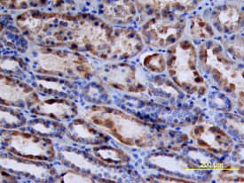 Renin antibody in Human Kidney by Immunohistochemistry (IHC-P).