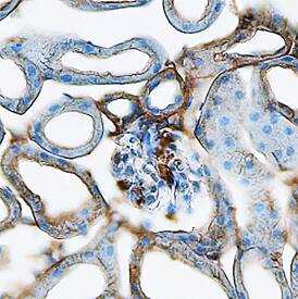 Renin antibody in Mouse Kidney by Immunohistochemistry (IHC-Fr).