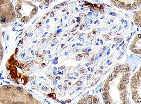 Renin antibody in Human Kidney by Immunohistochemistry (IHC-P).