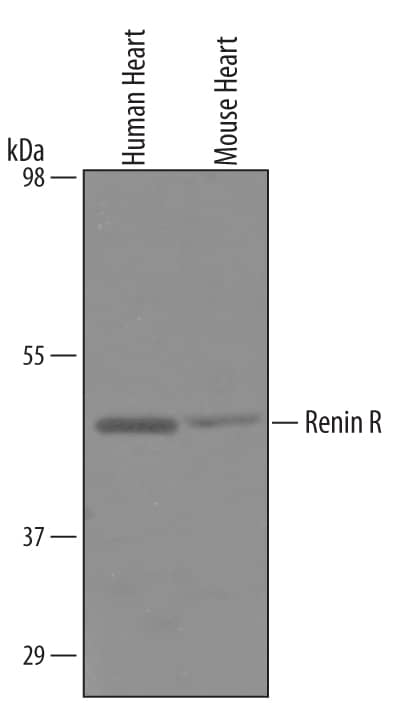 Detection of Human and Mouse Renin R antibody by Western Blot.