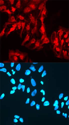 Rex-1/ZFP42 antibody in NTera-2 Human Cell Line by Immunocytochemistry (ICC).