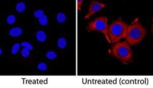 Phospho-Ribosomal Protein S6/RPS6 (S235/S236) antibody in MCF-7 Human Cell Line by Immunocytochemistry (ICC).